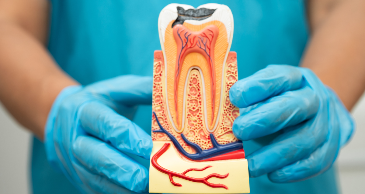 The Shocking Truth About Root Canals: 5 Myths Busted