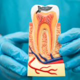 Root canals myth debunking at Dentistry in Motion North York Toronto